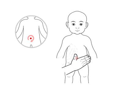 小兒推拿治療感冒嗎？