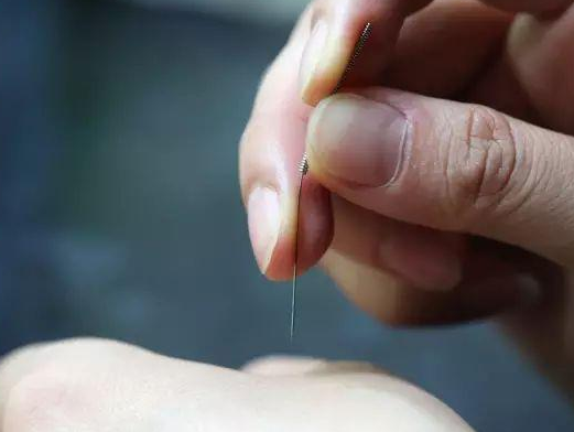 三棱針療法治療高燒嗎？